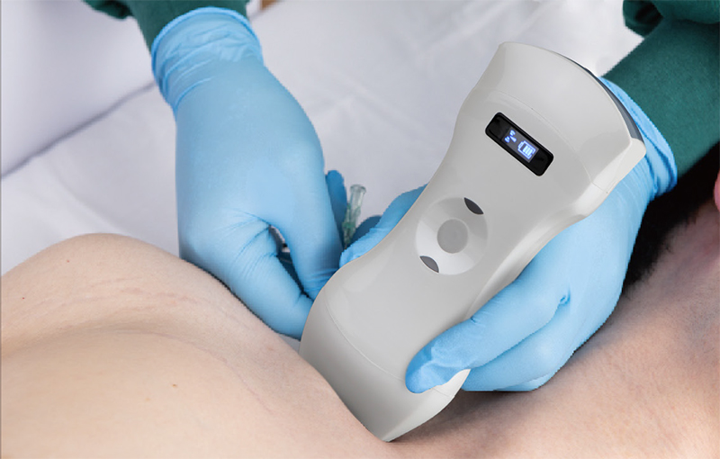 Application of Portable Imaging Technology by Handheld Ultrasound Manufacturers in Primary Care and 