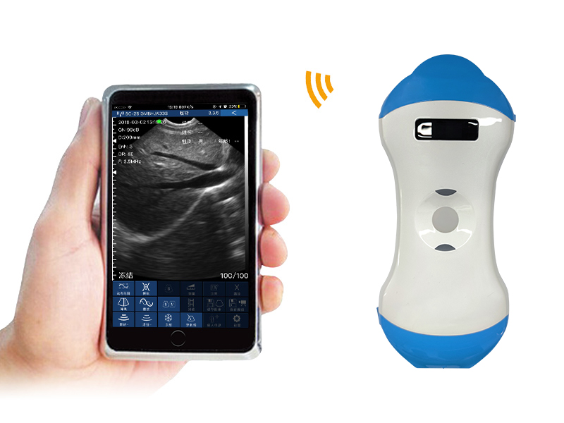 5MP 2in1 palm doppler ultrasound scanner