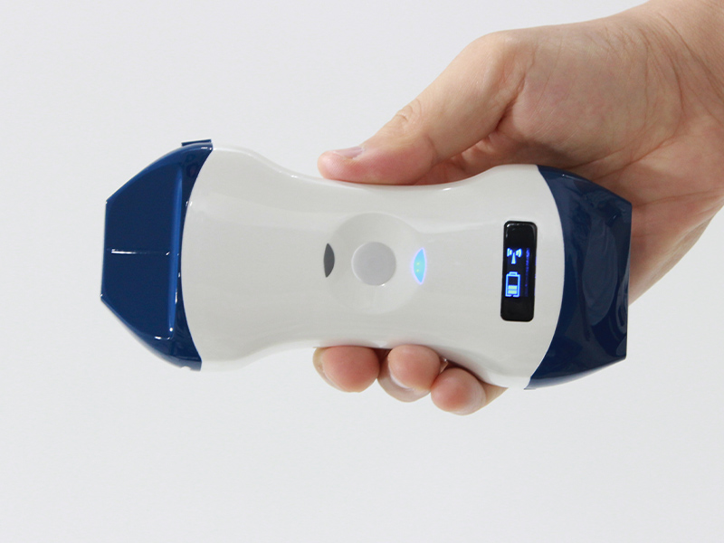 Is It Worth Deploying Wireless Handheld Ultrasound in Primary‑Care Clinics?