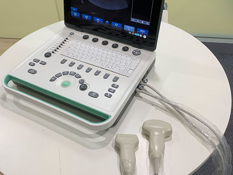 Why Emergency Centers and Community Hospitals Equip Wireless Portable Palm Ultrasound
