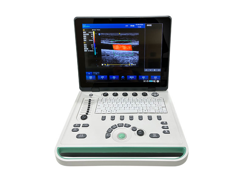 C5 Laptop Color Doppler