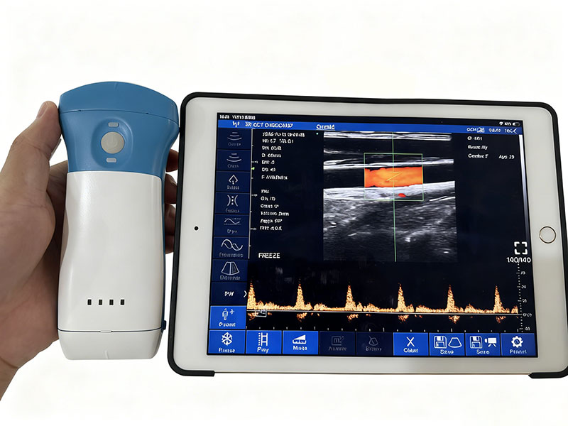 How Should Primary Clinics Choose the Right Portable Ultrasound Device