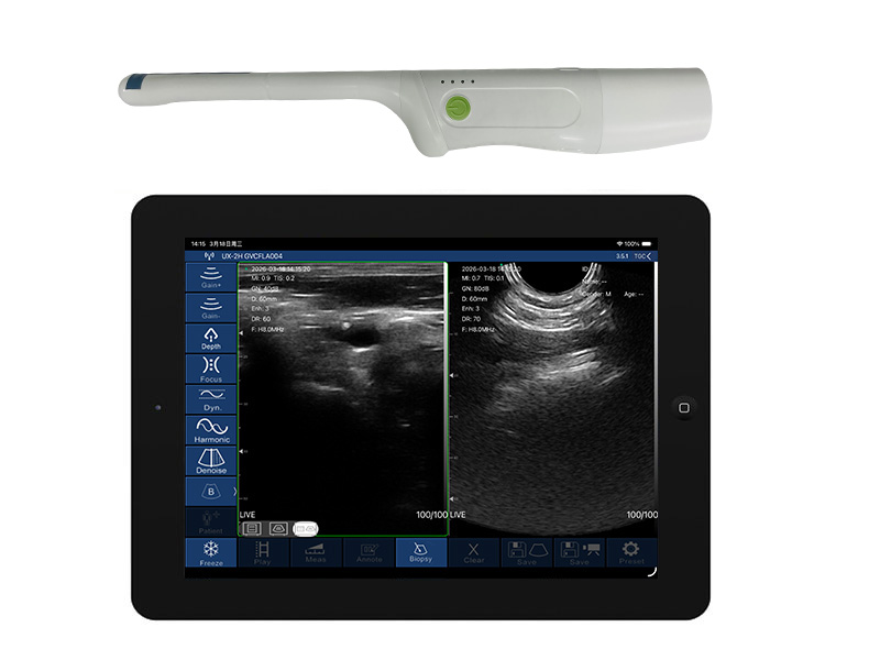 9CR biplane rectal palm doppler ultrasound scanner(VIP Exclusive)