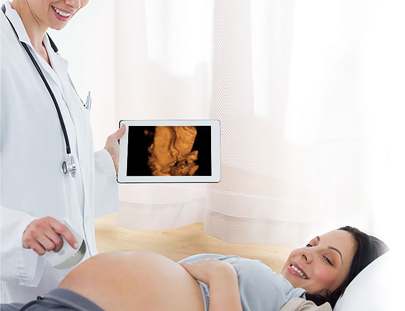 What Are the Application Scenarios of Sonostar Convex and Linear 4D Stereoscopic Handheld Ultrasound
