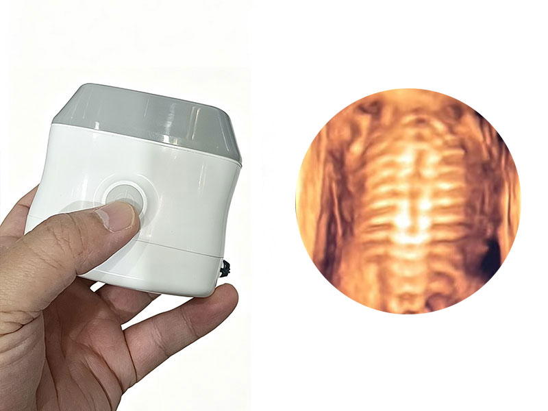 Portable Linear Array 4D 3D Imaging Ultrasound