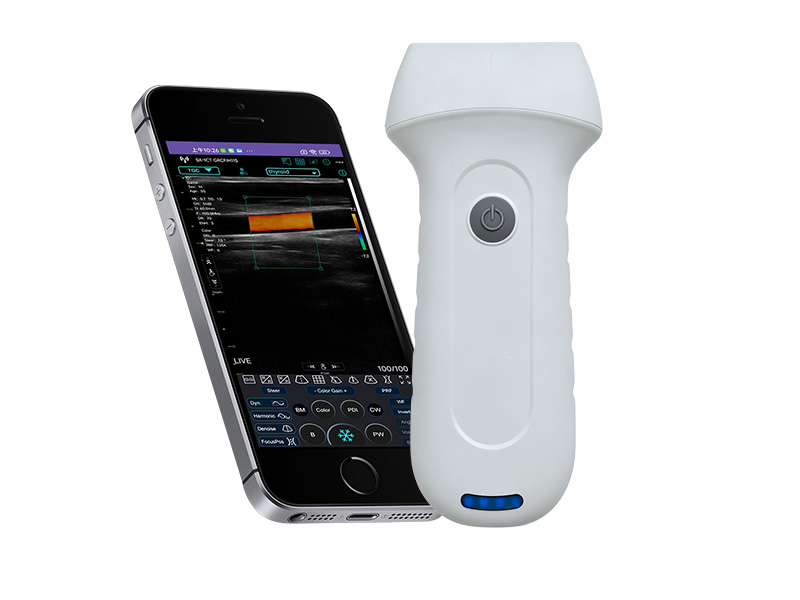 7L linear palm doppler ultrasound scanner