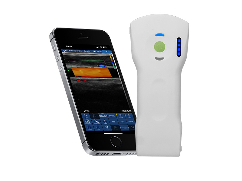 7CPL 3in1 palm doppler ultrasound scanner(VIP Exclusive)