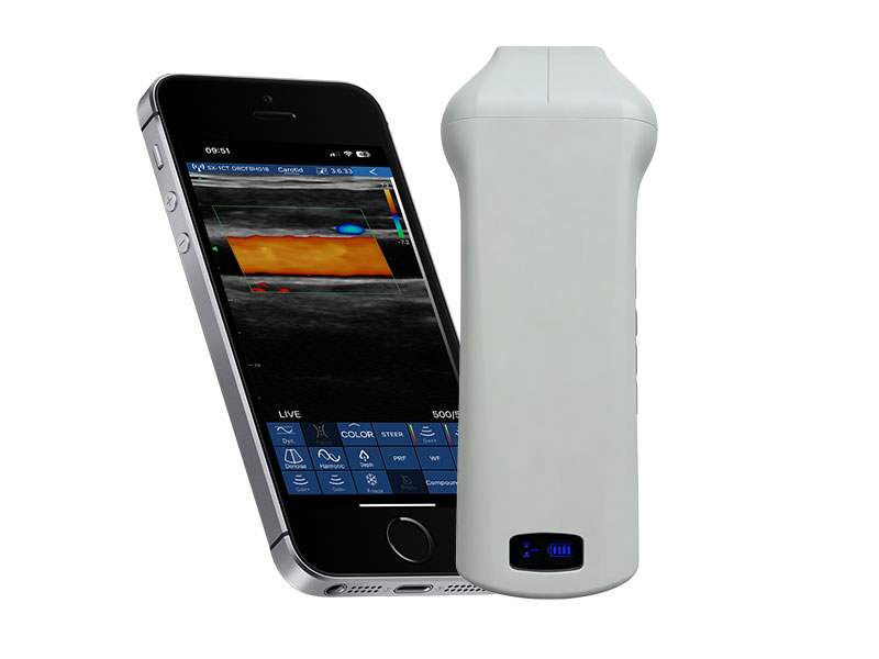 6N linear palm doppler ultrasound scanner