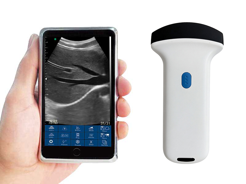 2C convex palm doppler ultrasound scanner