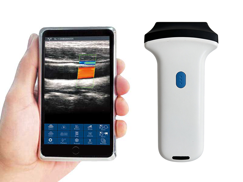 2L linear palm doppler ultrasound scanner